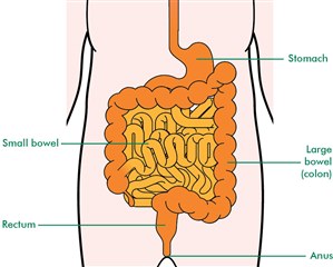 The image shows the large bowel and rectum in relation to other organs in the abdomen. Leading into the stomach is the tube called the gullet, or oesophagus. Below the stomach is the small bowel which is a long tube that is concertinaed in the abdomen and leads to the large bowel. This is a wider tube and starts on the left hand side as you look at it across the top of the abdomen and down the right hand side as you look at it. At this point it becomes the bigger pear-shaped rectum and at the lower end of this is the anus where the bowel opens to the outside of the body.