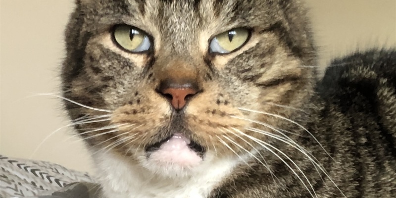 Meet Mr U - self advocating through cancer treatment with a pre-existing heart condition