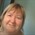 Coping with hair loss after a kidney cancer diagnosis: Ellie’s story