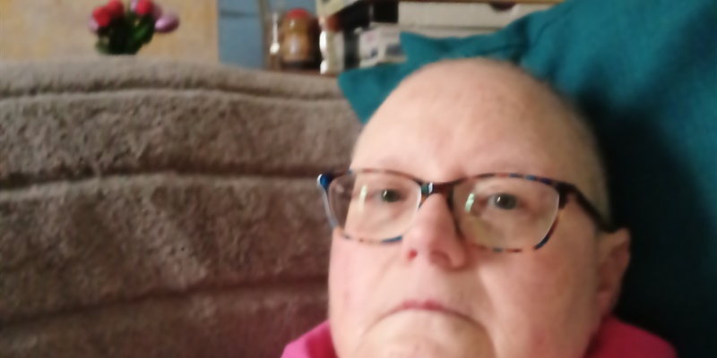 So? This is going bald?