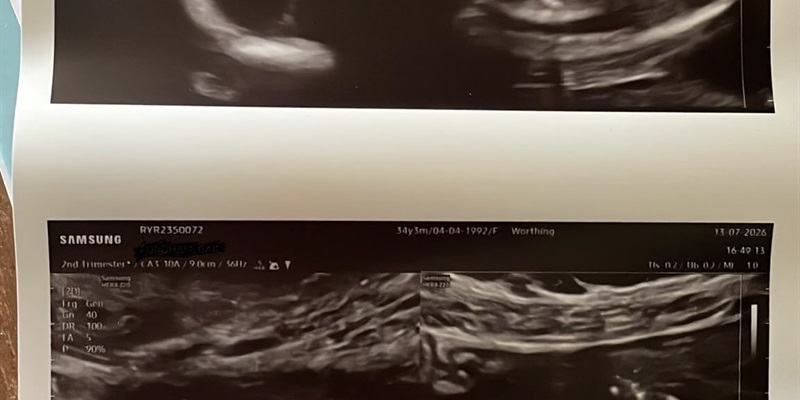 Post 451: It’s a Boy!