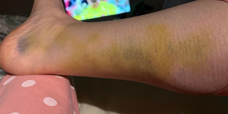 Post 444: Oh no… not again!
