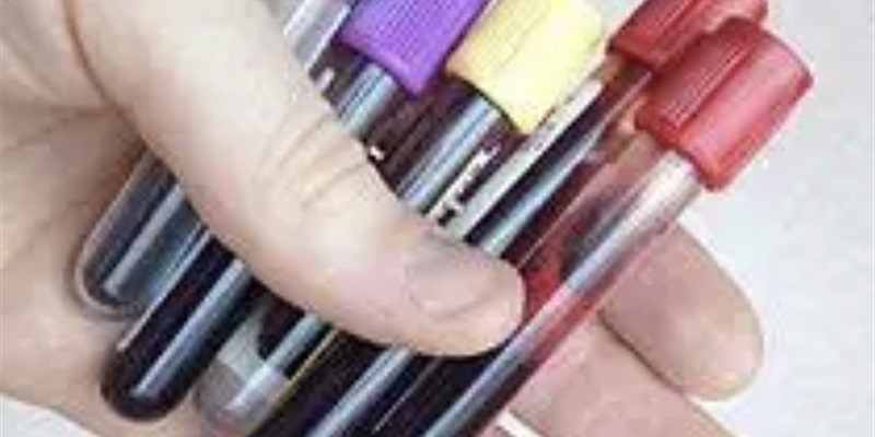 Post 388: Emergency Blood Test.