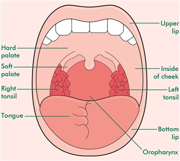 This is an illustration of the different parts of the mouth. It labels the upper lip, the hard palate, the soft palate, the inside of the cheek, the right and left tonsils, the tongue and the bottom lip