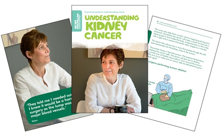 an image of our Understanding kidney cancer booklet