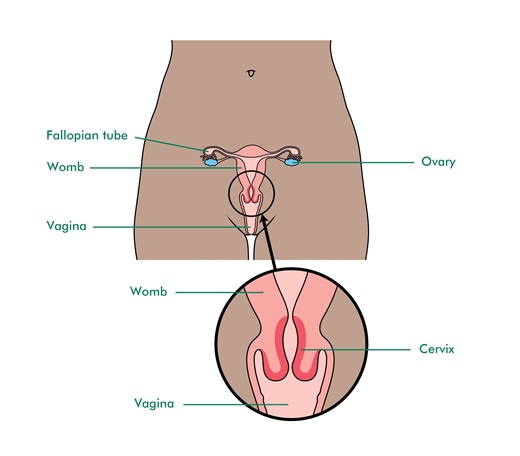 This image shows the location of the cervix. It shows a body, with the fallopian tube, womb, ovary and vagina labelled. It also shows a closer image of the area where the cervix is located, where the womb and the vagina meet.