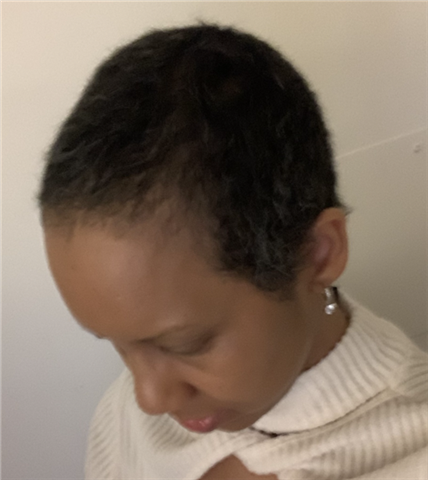 A photo of Wanda with very short dark afro hair growing back after chemo