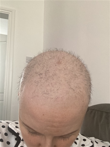 chemo macmillan