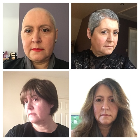 Of hair regrowth after chemo .... - Macmillan Online Community