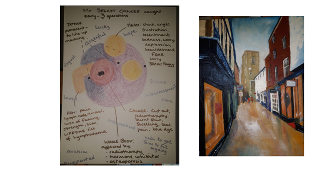  A hand-drawn diagram of breast cancer, next to a painting of an old British street.