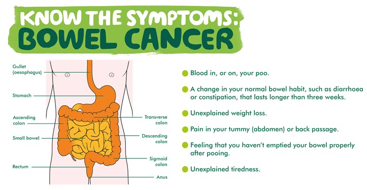 This is an image which shows the location of the bowel in the body. It also has a list of common symptoms of bowel cancer. These may not be caused by bowel cancer, but it's important to visit your GP to get them checked. The symptoms include: Blood in, or on, your poo. A change in your normal bowel habit, such as diarrhoea or constipation, that lasts longer than three weeks. Unexplained weight loss. Pain in your tummy (also called abdomen) or back passage (or rectum). Feeling that you haven't emptied your bowel properly after pooing. And unexplained tiredness.