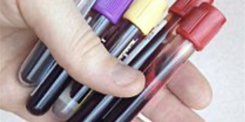 Post 297: Self advocacy rules my life.