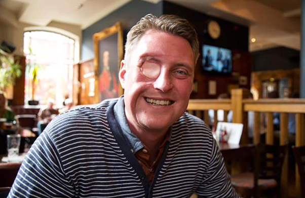 A portrait photo of a smiling Dan, after surgery to remove one eye.